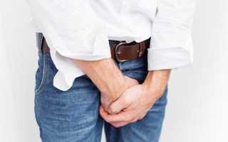 УЗИ кровеносного русла наружных половых органов у мужчин