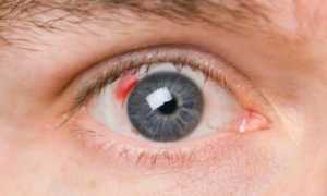 Ретинопатия: причины, виды, симптомы, основы диагностики и лечения