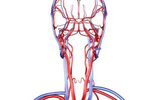 Тромбоз: опасное заболевание сосудов головы