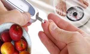 Стеноз сосудов в шейном отделе: причины и симптоматика патологии