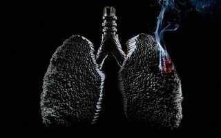 Все о раке легких на разных стадиях его развития