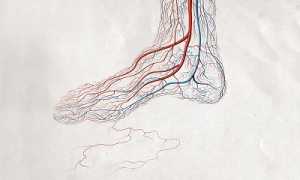 Болезни сосудов ног и способы их лечения