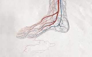 Болезни сосудов ног и способы их лечения