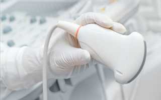 Роль ультразвуковых методов исследования в диагностике сосудистой патологии