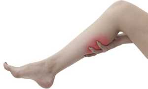 Как бороться с болями при варикозном расширении вен?