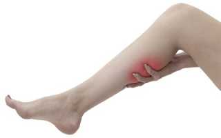 Как бороться с болями при варикозном расширении вен?