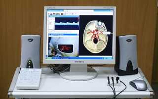 Современная диагностика сосудистых заболеваний при помощи компьютерной томографии