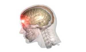 Причины, симптоматика и основы диагностики сосудистой лейкоэнцефалопатии