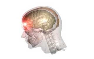 Причины, симптоматика и основы диагностики сосудистой лейкоэнцефалопатии