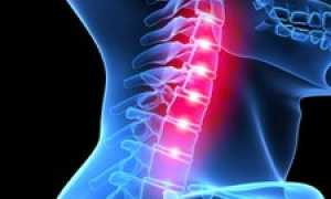 Головокружение, возникающее при повороте головы