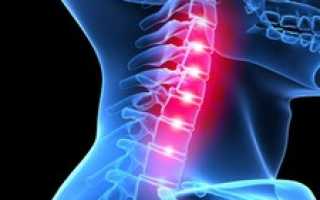 Головокружение, возникающее при повороте головы