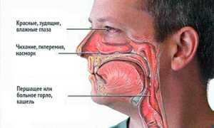 Головная боль лобной и глазной области
