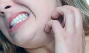 Найз в лечении головных болей