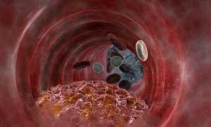 Снижения сердечного давления до 120 / 60: какие причины, насколько опасно и методы терапии