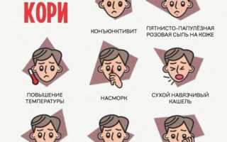 Особенности клинической картины при кори. Характеристика сыпи, сопутствующие симптомы