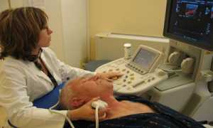 Диагностика сосудистых патологий головного мозга при помощи УЗИ