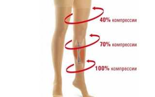 Колготки – эффективное средство профилактики и лечения варикоза
