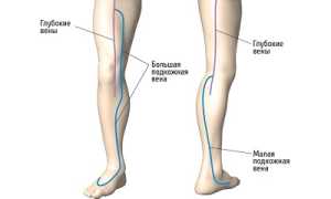Распространенные сосудистые заболевания нижних конечностей
