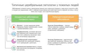 Чем грозен мозговой удар для пациентов пожилого возраста?