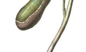 Билиарная гипертензия: виды, симптоматика и методы лечения