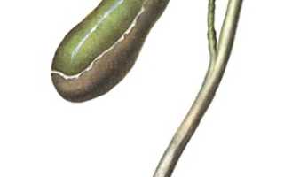 Билиарная гипертензия: виды, симптоматика и методы лечения