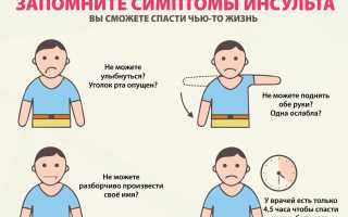 В деталях, о состоянии обширного инсульта