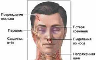 Общие первичные признаки наступающего мозгового удара