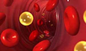 Выявление холестерина в крови: тонкости процедуры