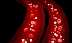 Почему кружится голова при ВСД?