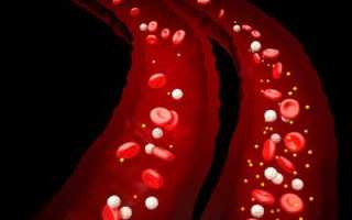 Исследование роли холестерина в крови: определение нормы