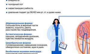 Инсульт и инфаркт – в чем сходства и различия признаков этих недугов?