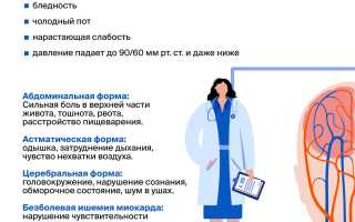 Инсульт и инфаркт – в чем сходства и различия признаков этих недугов?