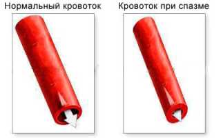 Церебральный ангиоспазм: подходы традиционной и нетрадиционной медицины