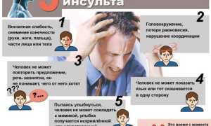 Основные признаки мозгового удара (инсульта) у человека