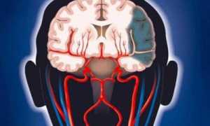 Можно ли снизить содержание липидов в организме своими силами?