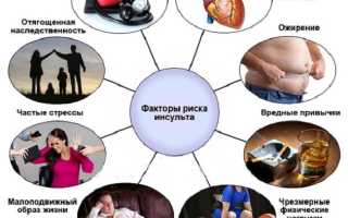 Способы и методы профилактики ишемического удара у взрослых и пожилых