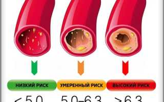 Правильное лечение повышенного холестерина