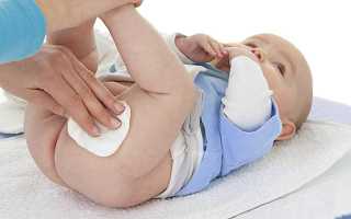 Лечение пеленочного дерматита у грудничков