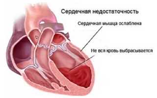Формы и клиническая картина острой сосудистой недостаточности у детей и взрослых
