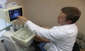 Варикоцеле и армия – можно ли служить?