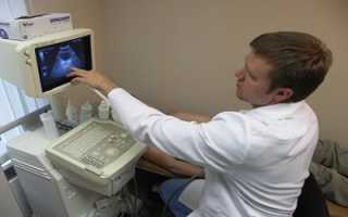 Варикоцеле и армия – можно ли служить?