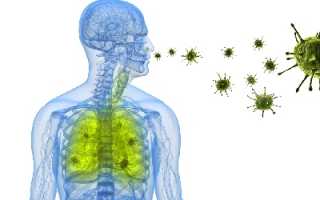 Нозокомиальная (внутрибольничная, госпитальная) пневмония