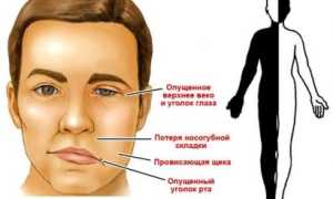 Прогнозы после геморрагического удара