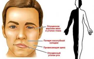 Прогнозы после геморрагического удара