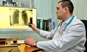 Застойная пневмония, как осложнение инсульта