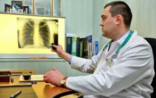 Застойная пневмония, как осложнение инсульта