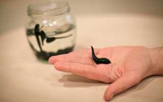 Гирудотерапия при варикозной болезни: показания, противопоказания, эффективность метода и техника выполнения