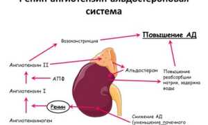 Реноваскулярная артериальная гипертензия: что собой представляет, симптоматика и методы терапии