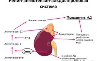 Реноваскулярная артериальная гипертензия: что собой представляет, симптоматика и методы терапии