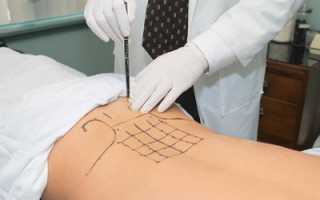 Применение технологий пролотерапии в ортопедии и артрологии